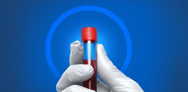 GUARDANT360®